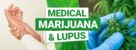 Weed and Lupus
